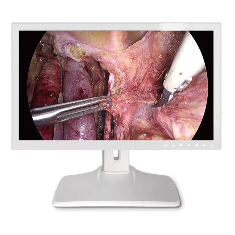 Monitor Medical 27inch 4K 