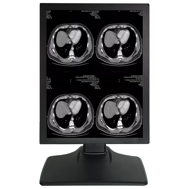 Monitor Medical 21.3inch 2MP Gri 