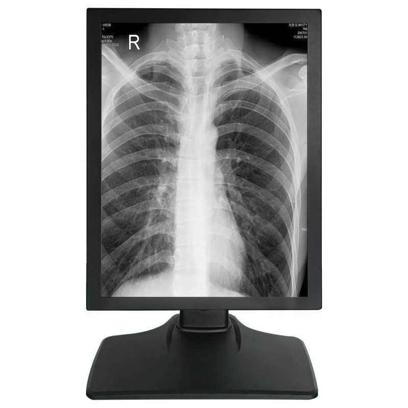 Monitor Medical 21.3inch 3MP Gri