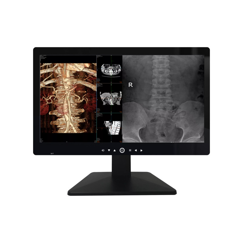 Monitor Medical 27inch 4MP Color