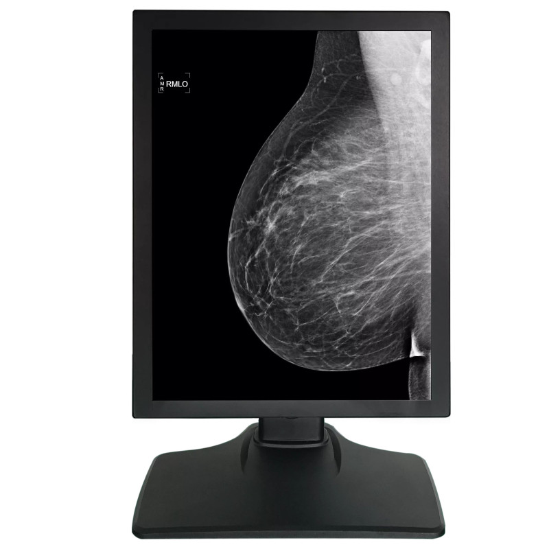 Monitor Medical 21.3inch 5MP Gri